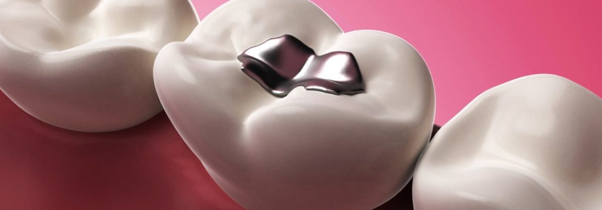 New Breakthrough Offers Hope of a Future Without Fillings