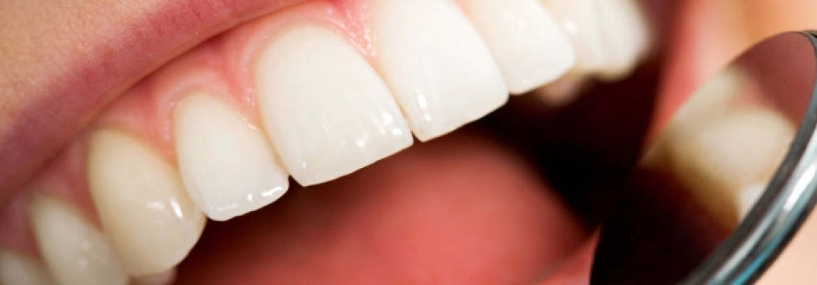 Teeth Whitening Basics